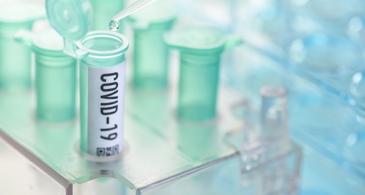 Corona virus: vial with pipette in laboratory